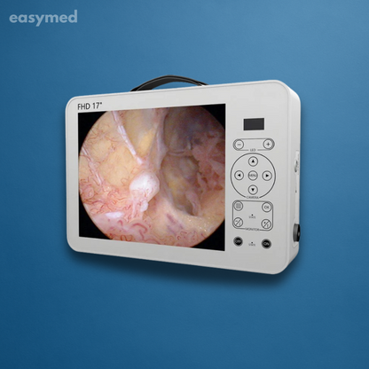 Sistema de Video Portátil para Endoscopia 17″ todo en uno